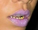 Los Dientes de Oro de Rihanna