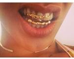 Las Joyas Dentales de Rihanna